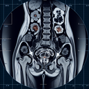 МРТ малого тазу у жінок