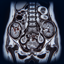 МРТ органів малого тазу